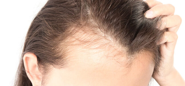 How To Reduce Hair Fall